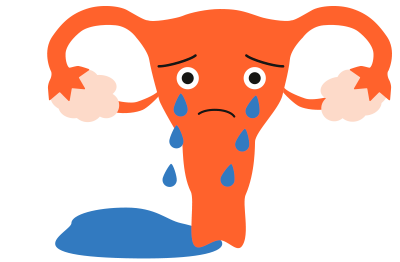 Illustration av melankolisk livmoder.